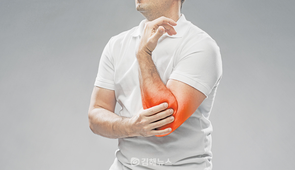 상과염은 손목관절 근육을 무리하게 사용할 경우 발생한다.